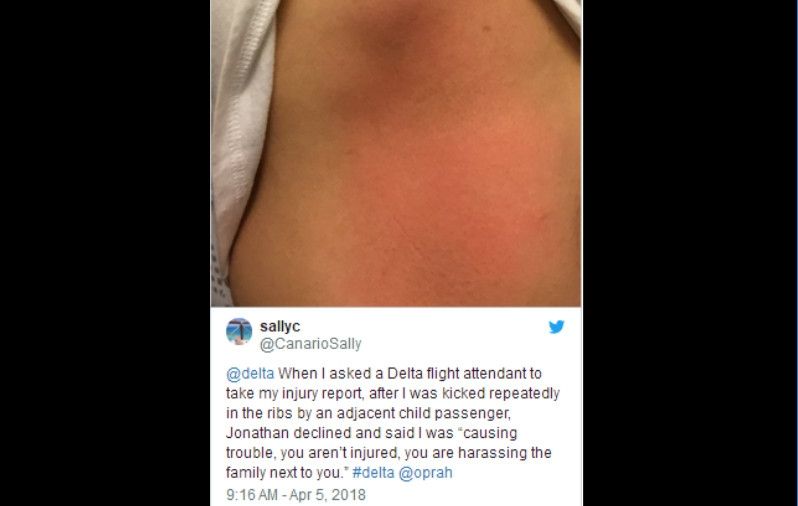 女子遭邻座女童踢伤肋骨 反被空乘指责“找麻烦”